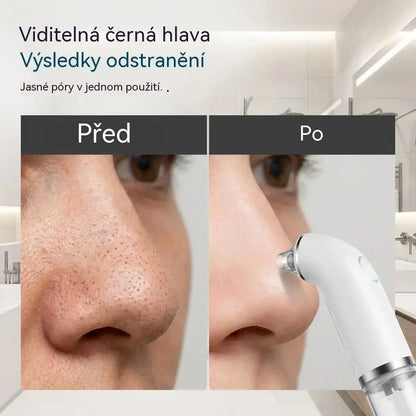 Elektrický čistič obličeje · Zpevnění a lifting · Hloubkové čištění pórů